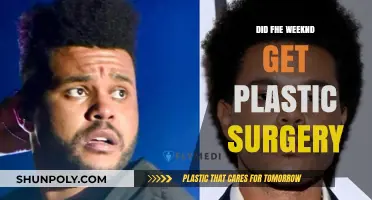 The Weeknd's Transformation: Plastic Surgery Rumors Explored and Debunked