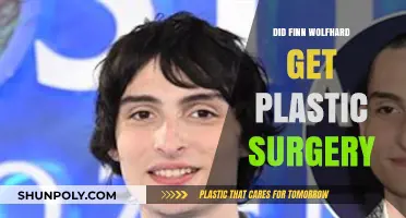 Finn Wolfhard Plastic Surgery: Fact-Checking the Rumors and Speculations