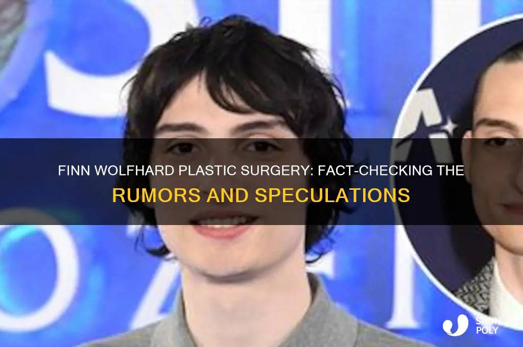 did finn wolfhard get plastic surgery