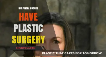 Did Finola Hughes Undergo Plastic Surgery? Unveiling the Truth