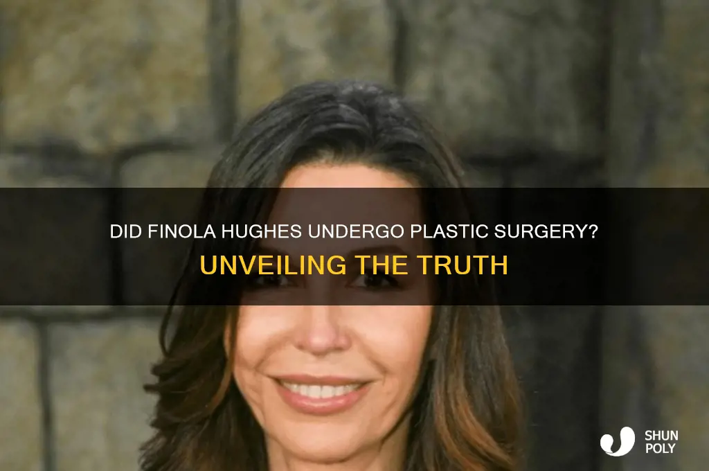 did finola hughes have plastic surgery