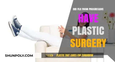 Did Flo from Progressive Get Plastic Surgery? Unveiling the Truth