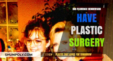 Florence Henderson's Plastic Surgery: Fact-Checking the Rumors and Speculations
