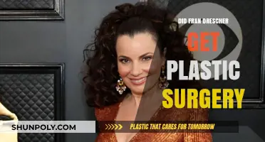 Did Fran Drescher Undergo Plastic Surgery? Unveiling the Truth