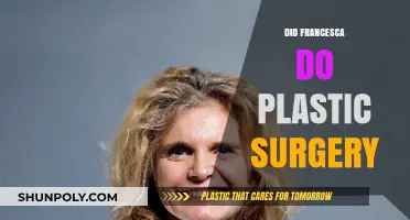 Francesca's Transformation: Unveiling the Truth About Plastic Surgery Rumors