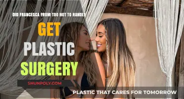 Francesca Farago's Transformation: Plastic Surgery Rumors Explored