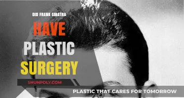 Frank Sinatra's Plastic Surgery: Fact or Fiction?