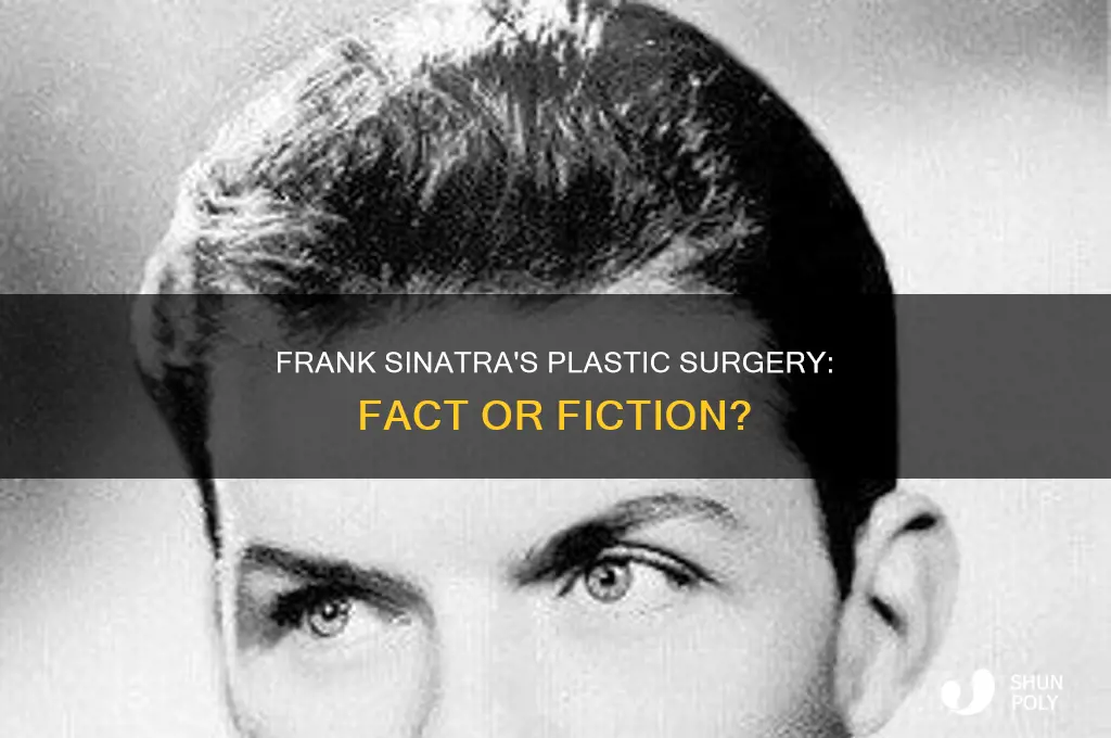 did frank sinatra have plastic surgery
