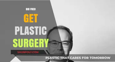 Did Fred Undergo Plastic Surgery? Unveiling the Truth Behind the Rumors