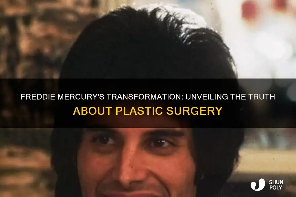 did freddie mercury get plastic surgery