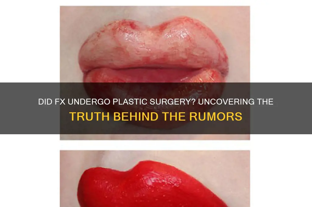 did fx get plastic surgery