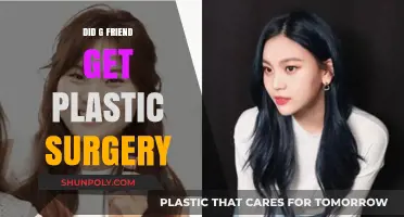 G-Friend's Transformation: Plastic Surgery Rumors and the Truth Behind Them