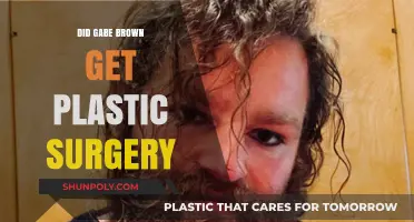 Gabe Brown's Transformation: Plastic Surgery Rumors Explored and Debunked