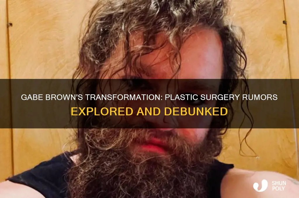 did gabe brown get plastic surgery