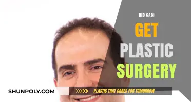 Did Gabi Undergo Plastic Surgery? Unveiling the Truth Behind Her Transformation