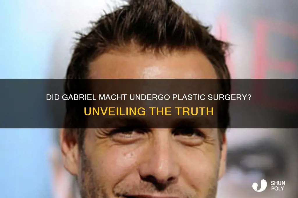 did gabriel macht have plastic surgery