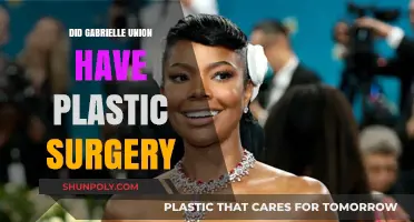 Gabrielle Union's Transformation: Plastic Surgery Rumors Explored and Debunked