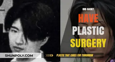 Gackt's Transformation: Unveiling the Truth About Plastic Surgery Rumors