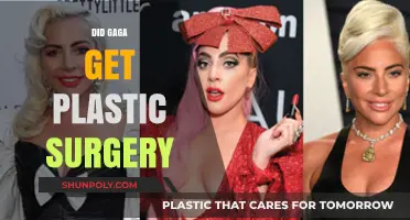 Did Lady Gaga Undergo Plastic Surgery? Unraveling the Truth