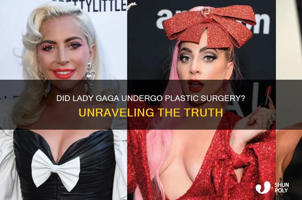 did gaga get plastic surgery