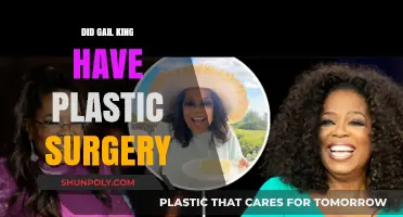 Gail King's Transformation: Plastic Surgery Rumors Explored and Debunked