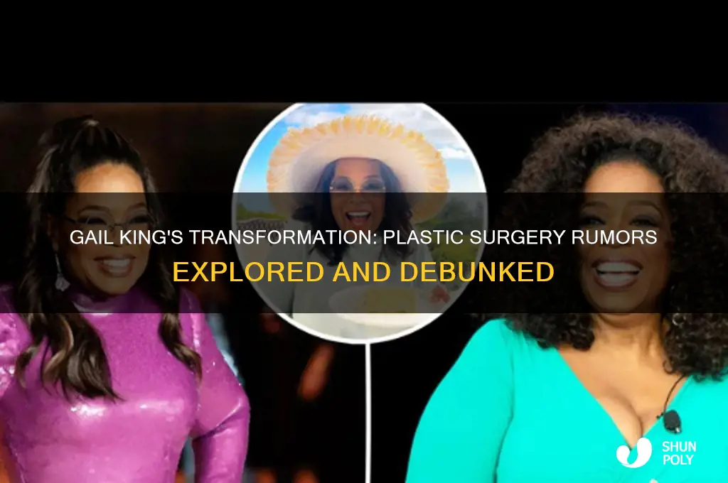 did gail king have plastic surgery