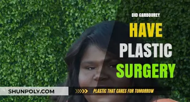 Did Gabourey Sidibe Undergo Plastic Surgery? Unveiling the Truth
