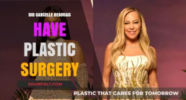 Garcelle Beauvais' Transformation: Plastic Surgery Speculations and Truths Revealed