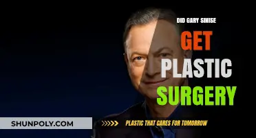 Gary Sinise Plastic Surgery: Fact-Checking the Transformation Rumors