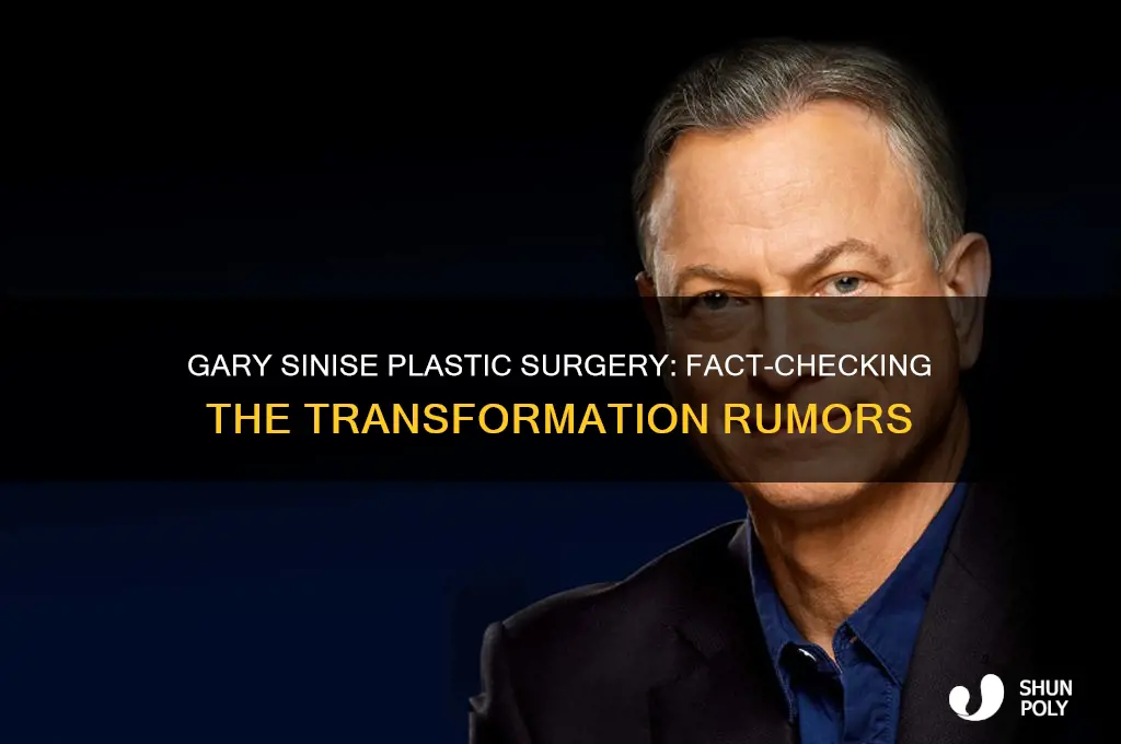 did gary sinise get plastic surgery
