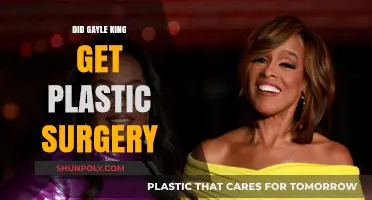 Gayle King's Transformation: Plastic Surgery Rumors Explored and Debunked