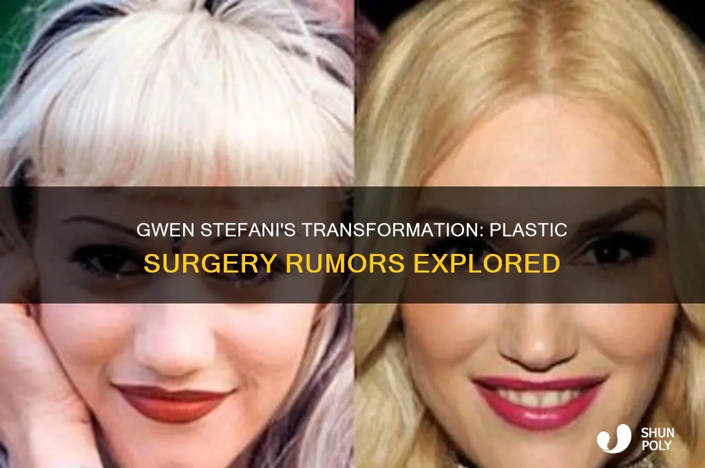 did geen stefani have plastic surgery