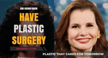 Geena Davis Plastic Surgery: Fact-Checking the Rumors and Speculations