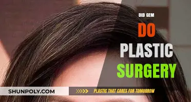 Did Gem Undergo Plastic Surgery? Unveiling the Truth Behind the Rumors