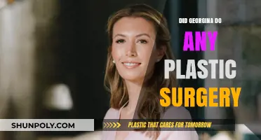 Georgina's Transformation: Unveiling the Truth About Plastic Surgery Speculations