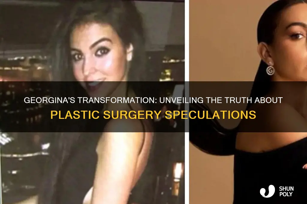did georgina do any plastic surgery