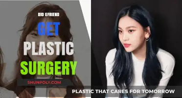GFRIEND's Transformation: Plastic Surgery Rumors and Realities Explored