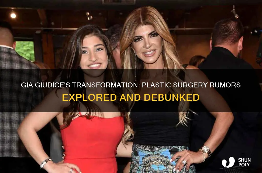 did gia guidice have plastic surgery