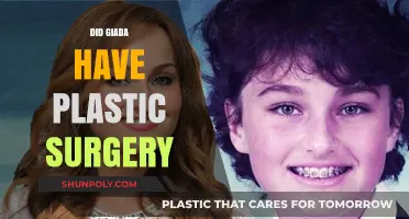 Giada De Laurentiis Plastic Surgery: Fact-Checking the Rumors and Speculations