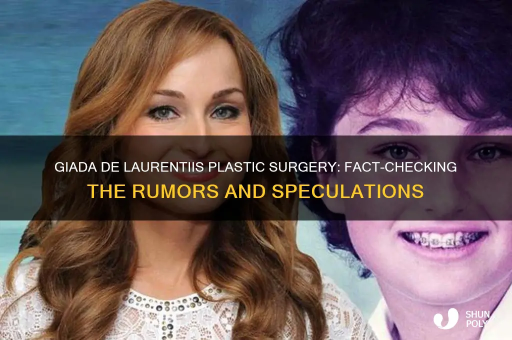 did giada have plastic surgery