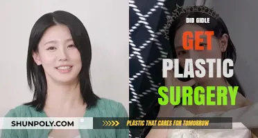 (G)I-DLE's Transformation: Plastic Surgery Rumors and Realities Explored