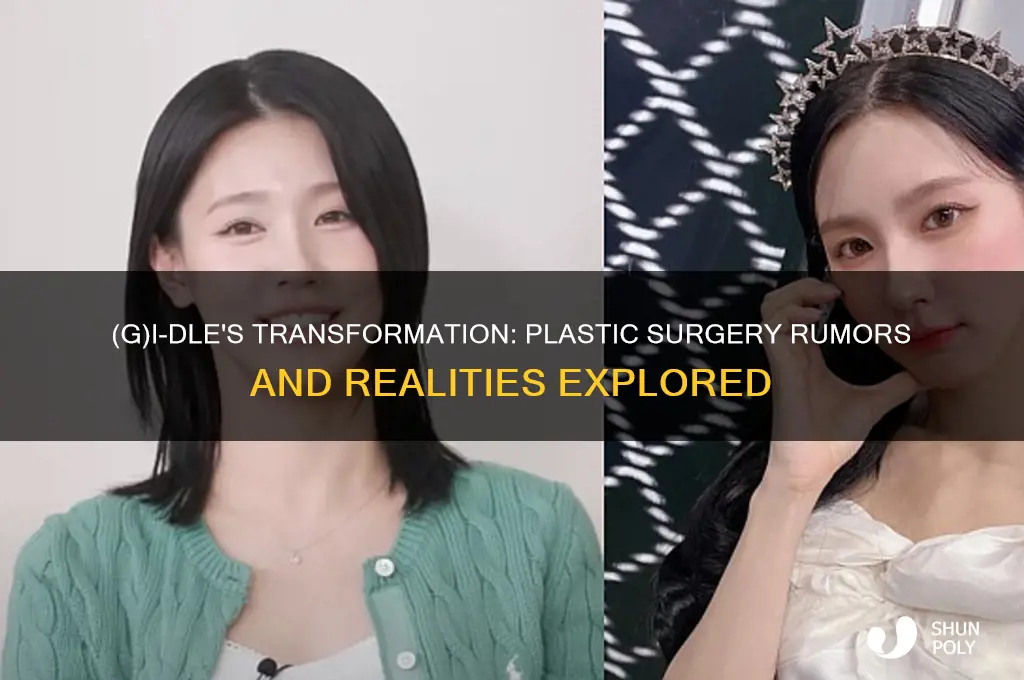 did gidle get plastic surgery