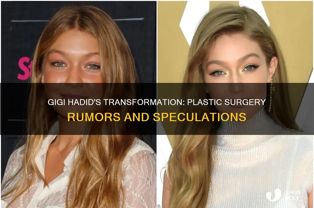 did gigi get plastic surgery