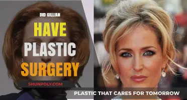 Gillian's Transformation: Plastic Surgery Speculations and the Truth Revealed
