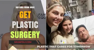 Gina Kirschenheiter's Transformation: RHOC Star's Plastic Surgery Speculations