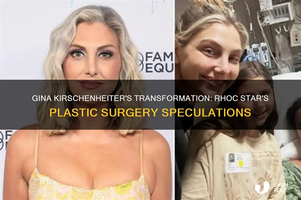 did gina from rhoc get plastic surgery