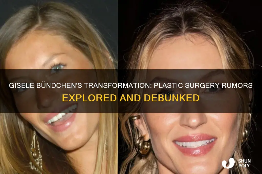 did gisele get plastic surgery