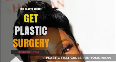 Did Gladys Knight Undergo Plastic Surgery? Unveiling the Truth