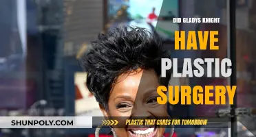 Did Gladys Knight Undergo Plastic Surgery? Unveiling the Truth