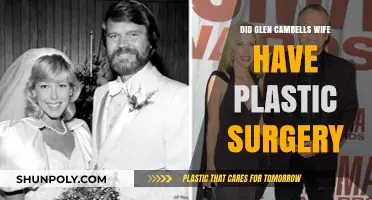 Glen Campbell's Wife: Plastic Surgery Speculations and Truths Revealed
